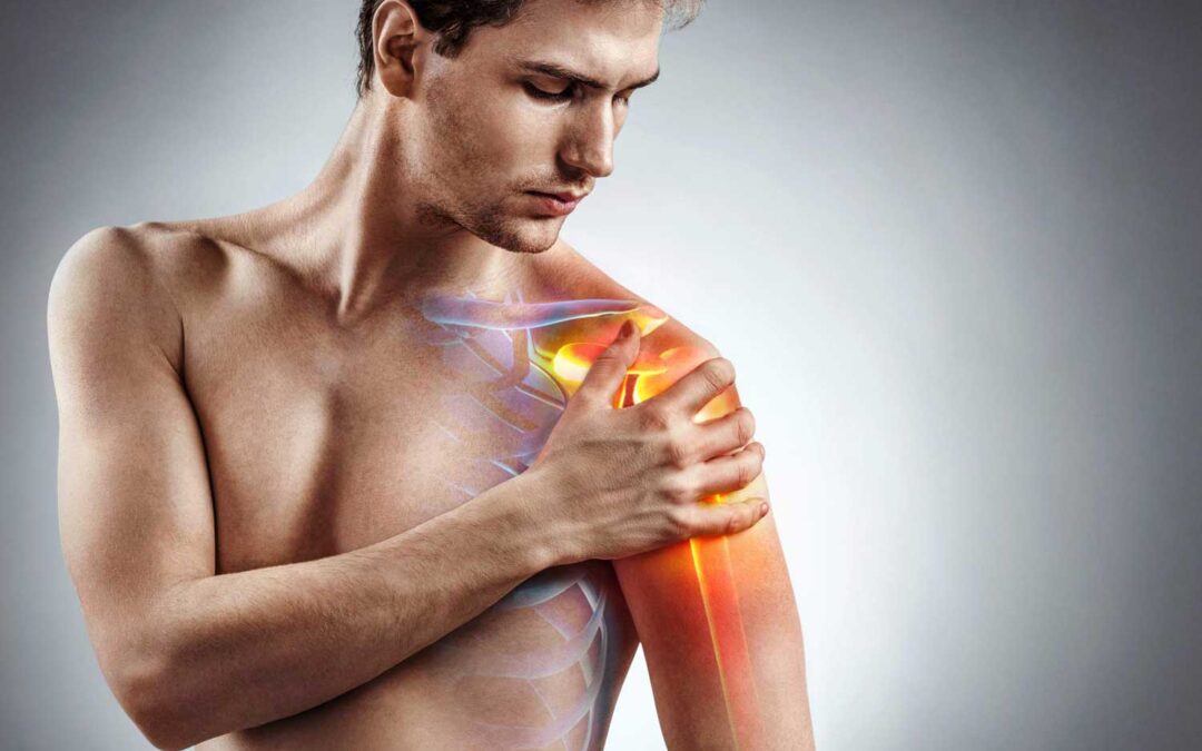 How Long Does It Take to Recover From a Dislocated Shoulder?