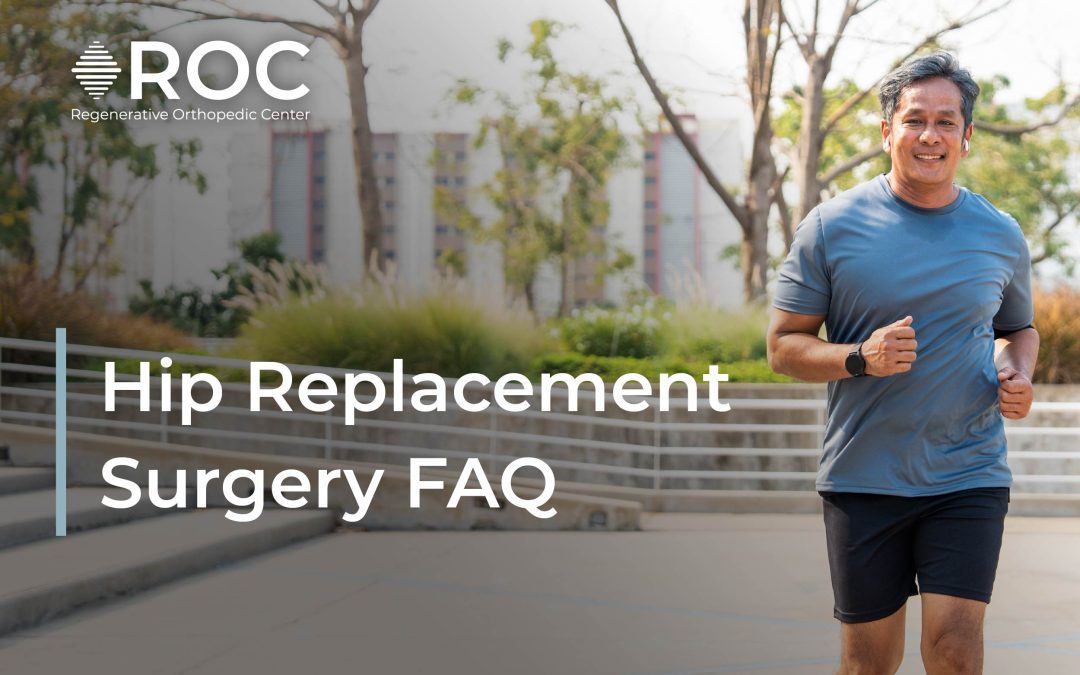 Hip Replacement Surgery FAQ