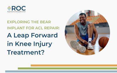 Exploring the BEAR Implant for ACL Repair: A Leap Forward in Knee Injury Treatment?